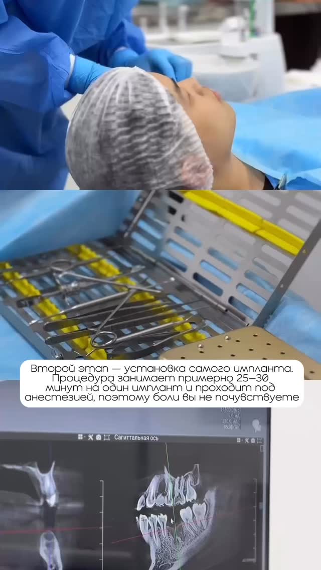 Коронка на импланте