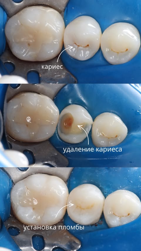 Результат работы ARTICON — до и после