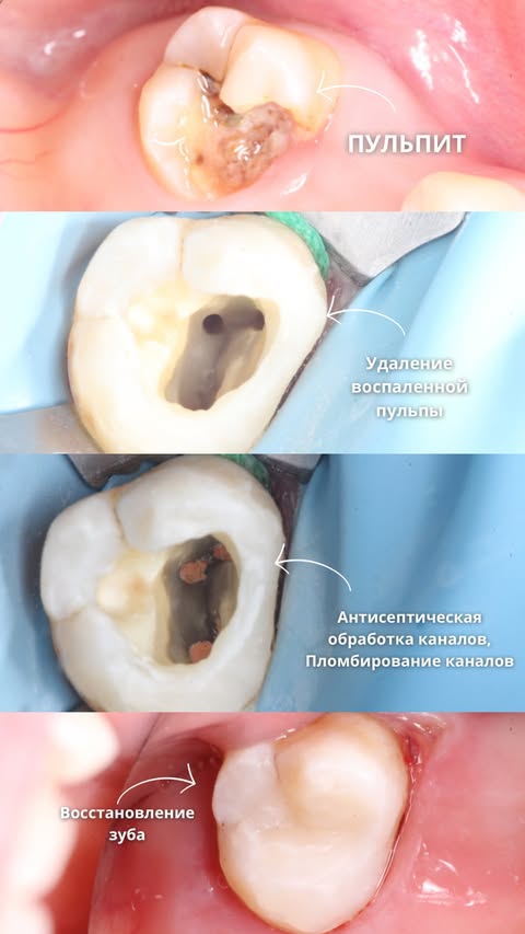 До и после: лечение и восстановление