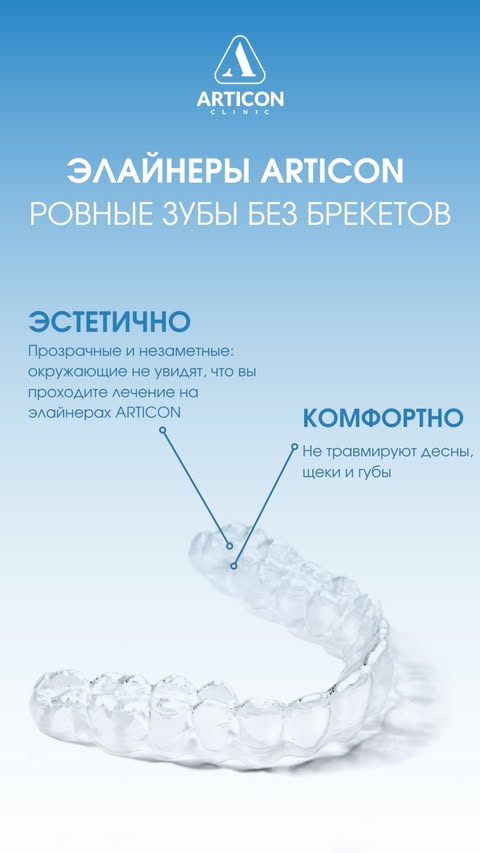 Элайнеры ARTICON